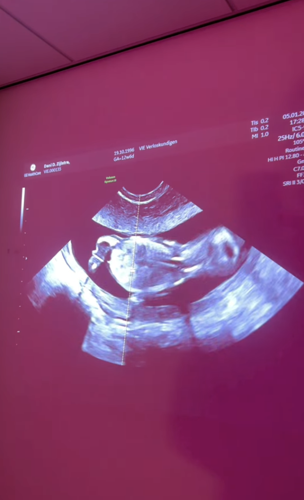 Scherm­afbeelding 2026 01 15 Om 19.10.03